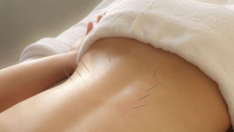Back pain and how acupuncture can help you