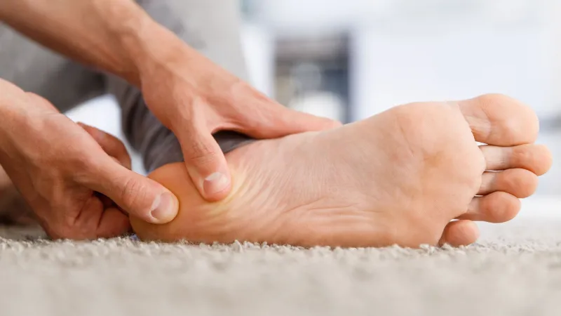 Plantar Fasciitis